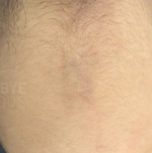 barely visible asian language symbol tattoo